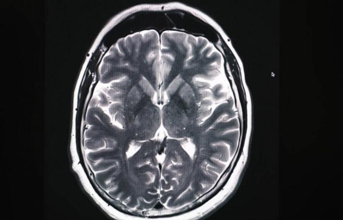 Le Prix de médecine Louis-Jeantet récompense la recherche sur le fonctionnement des neurones