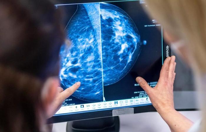 Au Luxembourg, le dépistage du cancer du sein progresse