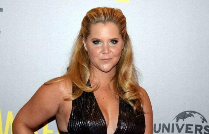 Amy Schumer a souffert du syndrome de Cushing