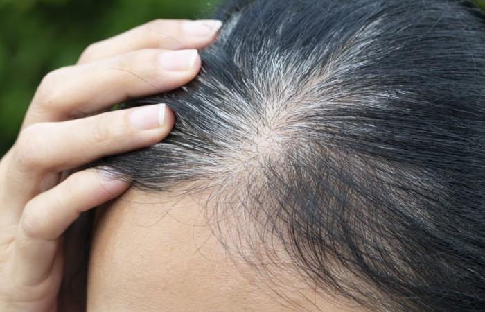 Les cheveux blancs peuvent-ils retrouver sa couleur?