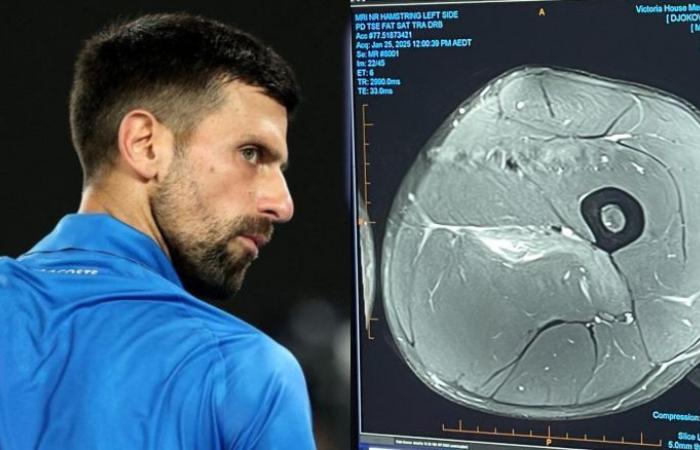 Tennis. Open d’Australie – Agacé, Novak Djokovic tacle les « experts » des blessures