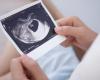 La pression dans l’utérus joue un rôle dans la formation du visage de votre bébé