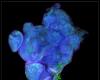 Découverte de cancers d’origine épigénétique sans mutation de l’ADN