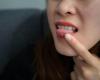 C’est ainsi qu’une petite « tache blanche » sur la langue peut se transformer en cancer mortel (VIDEO)