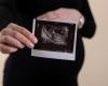 Des chercheurs révèlent comment se forme un embryon humain