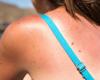 Les connaissances sur les dangers du soleil diminuent (Cancer Foundation)