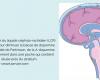 Traitement intracérébral pour lutter contre la maladie de Parkinson – Faire Face – .