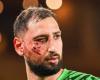 Traumatisme facial avec plaies multiples pour Donnarumma, forfait à Lens